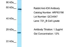 Western Blotting (WB) image for anti-Intestinal Cell (MAK-Like) Kinase (ICK) (C-Term) antibody (ABIN2789615)