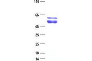 Validation with Western Blot