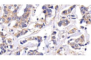 Detection of MMP7 in Human Mammary gland Tissue using Polyclonal Antibody to Matrix Metalloproteinase 7 (MMP7)