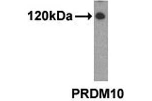 Western analysis of extracts from 293 cells using PRDM10 antibody. (PRDM10 anticorps  (N-Term))