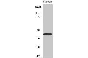 Western Blotting (WB) image for anti-Family with Sequence Similarity 203, Member B (FAM203B) (Internal Region) antibody (ABIN3183554)