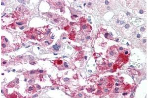 Anti-BAD antibody IHC staining of human adrenal. (BAD anticorps  (AA 119-168))