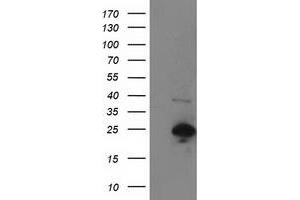 Image no. 1 for anti-Synovial Sarcoma, X Breakpoint 1 (SSX1) antibody (ABIN1501160) (SSX1 anticorps)