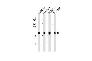 Western blot analysis of lysates from SW480 cell line, human brain, mouse brain and rat brain tissue lysate(from left to right), using VILIP1 Antibody at 1:1000 at each lane. (VSNL1 anticorps  (C-Term))