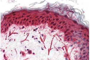 Anti-FZD3 / Frizzled 3 antibody  ABIN1048620 IHC staining of human skin.