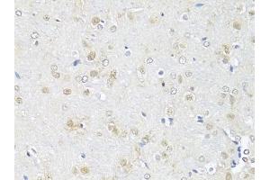 Immunohistochemistry of paraffin-embedded rat brain using RBFOX3 antibody (ABIN1874561) at dilution of 1:100 (40x lens). (NeuN anticorps)