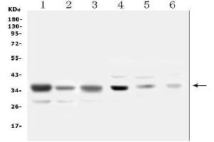 Western blot analysis of SFRP1 using anti-SFRP1 antibody (ABIN6719484). (SFRP1 anticorps)