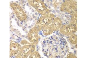 Immunohistochemistry of paraffin-embedded Rat kidney using AKR1A1 Polyclonal Antibody at dilution of 1:100 (40x lens).