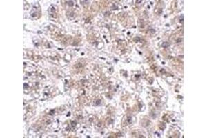 Immunohistochemistry of AFAP1L2 in human liver tissue with AFAP1L2 antibody at 2. (AFAP1L2 anticorps  (C-Term))