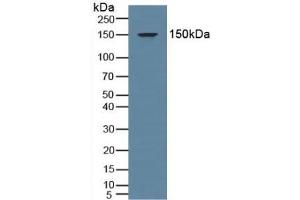 Detection of MR in Human Serum using Polyclonal Antibody to Mineralocorticoid Receptor (MR)