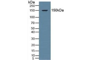 Detection of MR in Human Serum using Polyclonal Antibody to Mineralocorticoid Receptor (MR) (NR3C2 anticorps  (AA 739-984))