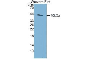 Western Blotting (WB) image for anti-Ubiquitin Protein Ligase E3A (ube3a) (AA 158-407) antibody (ABIN1860894) (ube3a anticorps  (AA 158-407))