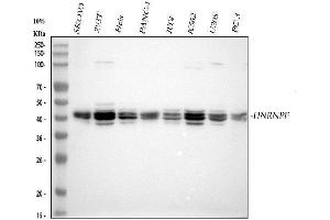 Western blot analysis of HnRNPF using anti-HnRNPF antibody (ABIN4886622). (HNRNPF anticorps  (N-Term))
