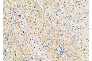 ABIN6258429 and ABIN6274809 at 1/100 staining Rat heart tissue by IHC-P.
