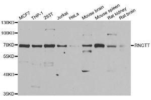Western blot analysis of extracts of various cell lines, using RNGTT antibody. (RNGTT anticorps)