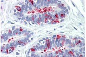 anti-Cathepsin C (CTSC) antibody