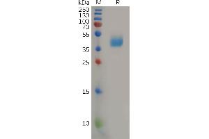 Human Protein, hFc Tag on SDS-PAGE under reducing condition.