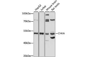 Western blot analysis of extracts of various cell lines, using CHKA antibody (ABIN6294191) at 1:1000 dilution. (Choline Kinase alpha anticorps)