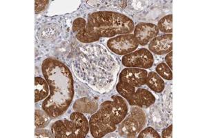 Immunohistochemical staining of human kidney with KCNJ12 polyclonal antibody  shows strong cytoplasmic positivity in tubular cells at 1:200-1:500 dilution. (Kir2.2 anticorps)