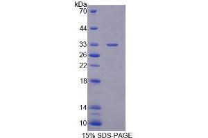 SDS-PAGE analysis of Human PLCb4 Protein.