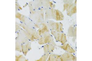 Immunohistochemistry of paraffin-embedded rat skeletal muscle using TRAP1 Antibody (ABIN5971463) at dilution of 1/100 (40x lens). (TRAP1 anticorps)
