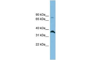 WB Suggested Anti-SLC6A15 Antibody Titration: 0. (SLC6A15 anticorps  (Middle Region))