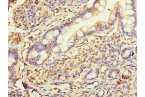 Immunohistochemistry of paraffin-embedded human small intestine tissue using ABIN7175449 at dilution of 1:100 (HSD17B12 anticorps  (AA 40-181))