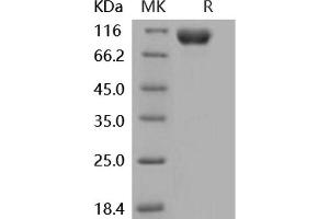 Western Blotting (WB) image for Interleukin 18 Receptor 1 (IL18R1) (Active) protein (His tag,Fc Tag) (ABIN7196449)
