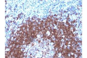IHC testing of FFPE human tonsil with recombinant CD79a antibody (clone IGA/1790R). (Recombinant CD79a anticorps  (AA 202-216))