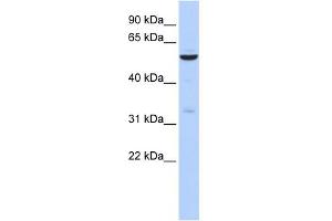 WB Suggested Anti-ZNF266 Antibody Titration:  0. (ZNF266 anticorps  (N-Term))