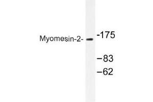 Image no. 1 for anti-Myomesin 2 (MYOM2) antibody (ABIN317920) (MYOM2 anticorps)
