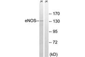 Western blot analysis of extracts from Jurkat cells, treated with Insulin 0. (ENOS anticorps  (AA 1144-1193))