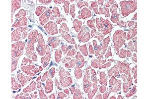 Anti-SLITRK6 antibody IHC of human heart.