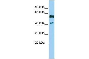 Host: Rabbit Target Name: GPR114 Sample Type: MDA-MB-435S Whole Cell lysates Antibody Dilution: 1. (GPR114 anticorps  (Middle Region))