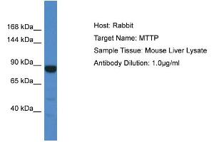 Host: Rabbit Target Name: MTTP Sample Tissue: Mouse Liver Antibody Dilution: 1ug/ml