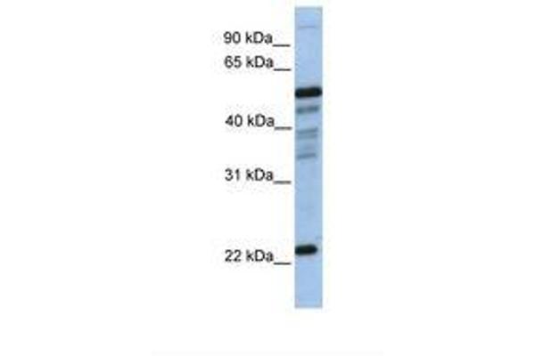 HPGDS anticorps  (N-Term)