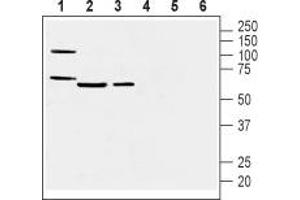 Western blot analysis of mouse heart membranes (lanes 1 and 4), mouse lung lysate (lanes 2 and 5) and rat lung membranes (lanes 3 and 6): - 1-3. (Prostacyclin Receptor anticorps  (3rd Extracellular Loop))