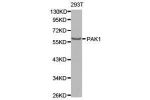 Western Blotting (WB) image for anti-P21-Activated Kinase 1 (PAK1) antibody (ABIN1874026) (PAK1 anticorps)