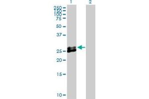 Western Blot analysis of EPDR1 expression in transfected 293T cell line by EPDR1 MaxPab polyclonal antibody. (EPDR1 anticorps  (AA 1-224))