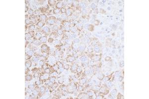 Immunohistochemistry (IHC) image for anti-ATP Synthase, H+ Transporting, Mitochondrial F1 Complex, alpha Subunit 1, Cardiac Muscle (ATP5A1) (AA 100-150) antibody (ABIN7453912)