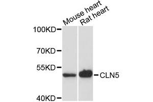 Western blot analysis of extracts of various cell lines, using CLN5 antibody. (CLN5 anticorps)