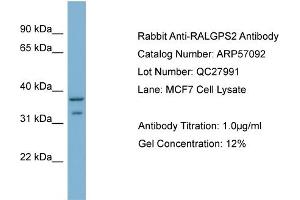 WB Suggested Anti-RALGPS2  Antibody Titration: 0. (RALGPS2 anticorps  (C-Term))
