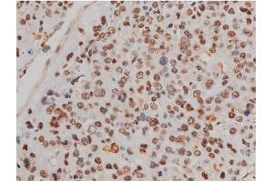 ABIN6267433 at 1/200 staining Human tonsil tissue sections by IHC-P.