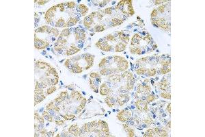 Immunohistochemistry of paraffin-embedded human stomach using TNFRSF10A antibody. (TNFRSF10A anticorps  (AA 269-468))