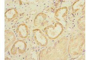 Immunohistochemistry of paraffin-embedded human kidney tissue using ABIN7170032 at dilution of 1:100