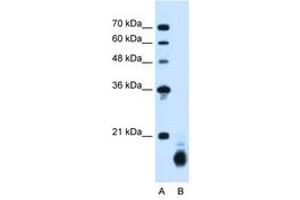 Image no. 2 for anti-Cyclophilin B (PPIB) (C-Term) antibody (ABIN205044)
