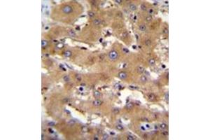anti-PHD Finger Protein 12 (PHF12) (AA 838-866), (C-Term) antibody