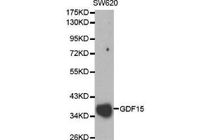 Western blot analysis of SW620 cell lysate using GDF15 antibody. (GDF15 anticorps  (AA 49-308))