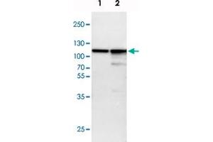 Western blot analysis of Lane 1: NIH-3T3 cell lysate (Mouse embryonic fibroblast cells), Lane 2: NBT-II cell lysate (Rat Wistar bladder tumour cells) with ACTN4 polyclonal antibody  at 1:100-1:500 dilution. (alpha Actinin 4 anticorps)