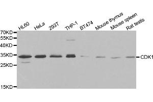 Western blot analysis of extracts of various cell lines, using CDK1 antibody (ABIN5970051) at 1/1000 dilution. (CDK1 anticorps  (Center))